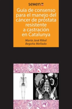 Guías de consenso para el manejo del cáncer de próstata resistente a castración en Catalunya